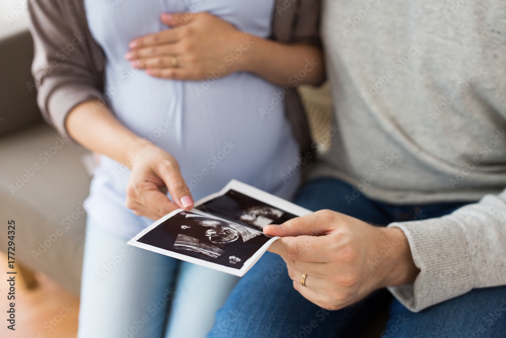 close up of couple with baby ultrasound images close up of couple with baby ultrasound images