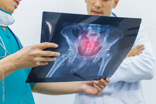 Two doctors are diagnosing the symptoms of a patient from x-ray at hip bone. concept of medical consult and treatment marrow.