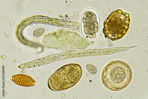 Helminthes in stool, analyze by microscope
 photo