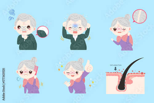 old people with dandruff problem