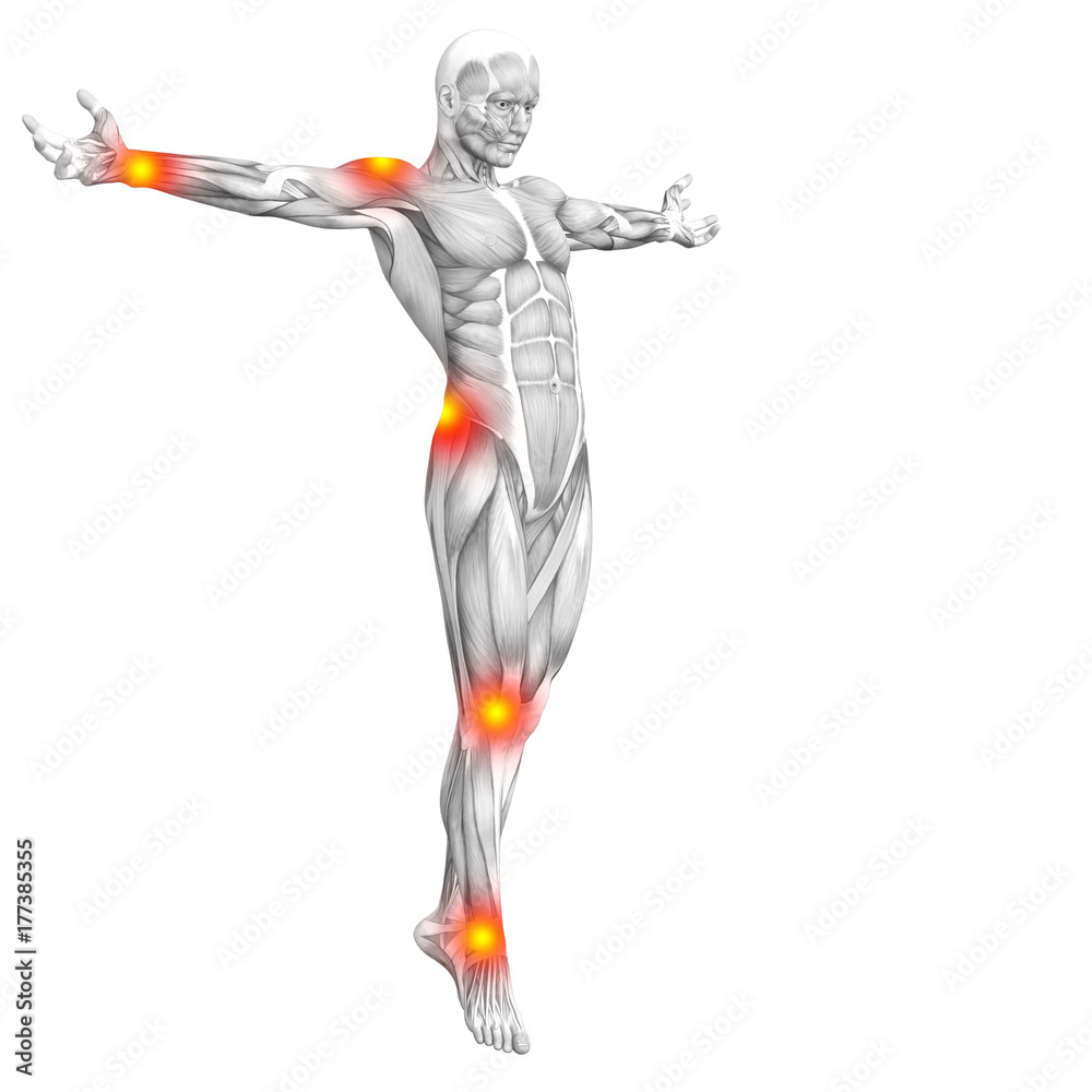 Conceptual human muscle anatomy with red and yellow hot spot inflammation or articular joint pain for health care therapy or sport concepts. 3D illustration man arthritis or bone osteoporosis disease Conceptual human muscle anatomy with red and yellow hot spot inflammation or articular joint pain for health care therapy or sport concepts. 3D illustration man arthritis or bone osteoporosis disease