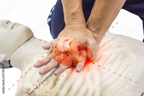 Obraz na płótnie cpr training
