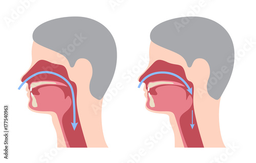 a snoring infographic / vector