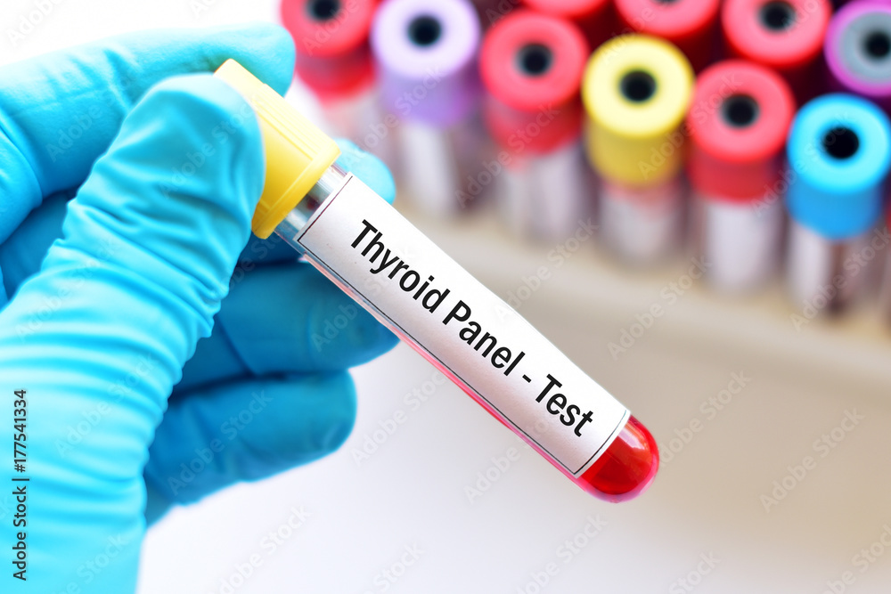 Obraz premium Blood for thyroid panel test