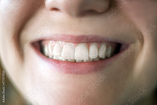 Real Healthy Teeth of Young Woman