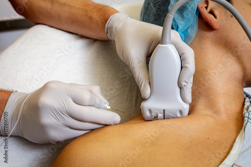 Sonography guided nerve block