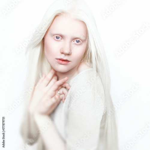 Albino girl with white skin, natural lips and white hair. Photo face on a light background. Portrait of the head. Blonde girl