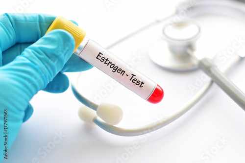 Estrogen hormone test