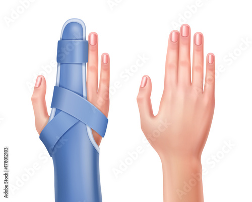 Hand with brace