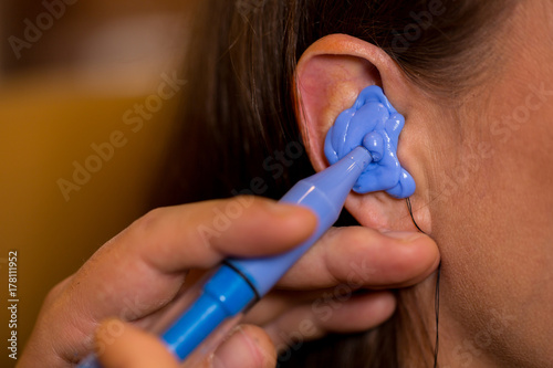 hearing aid acoustician making mold of the ear canal