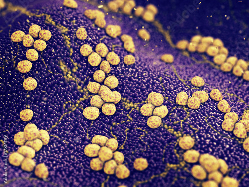 Colony of Staphylococcus aureus bacteria causing skin infection , Antibiotic resistant infectious diseases photo