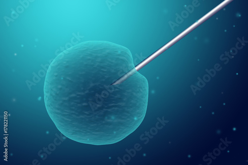 in vitro fertilization
