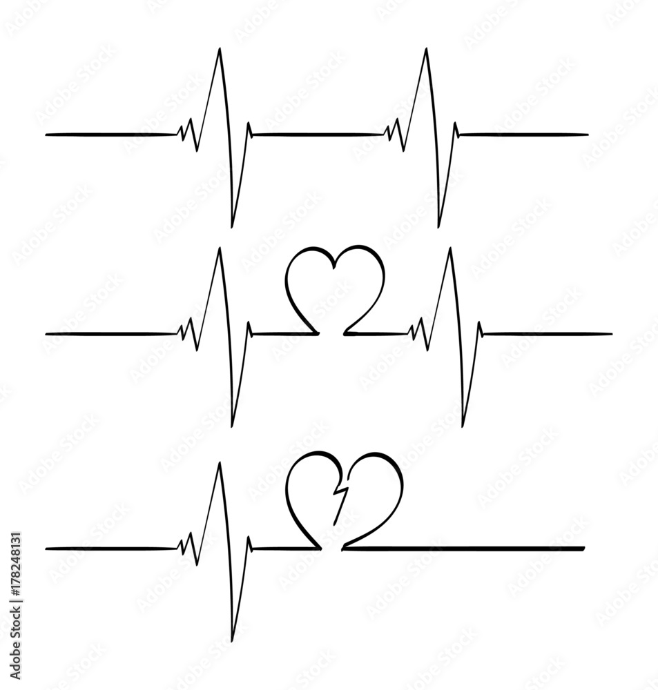 3 lines of heart beats, normal, love, and heart broken. Stock Vector |  Adobe Stock