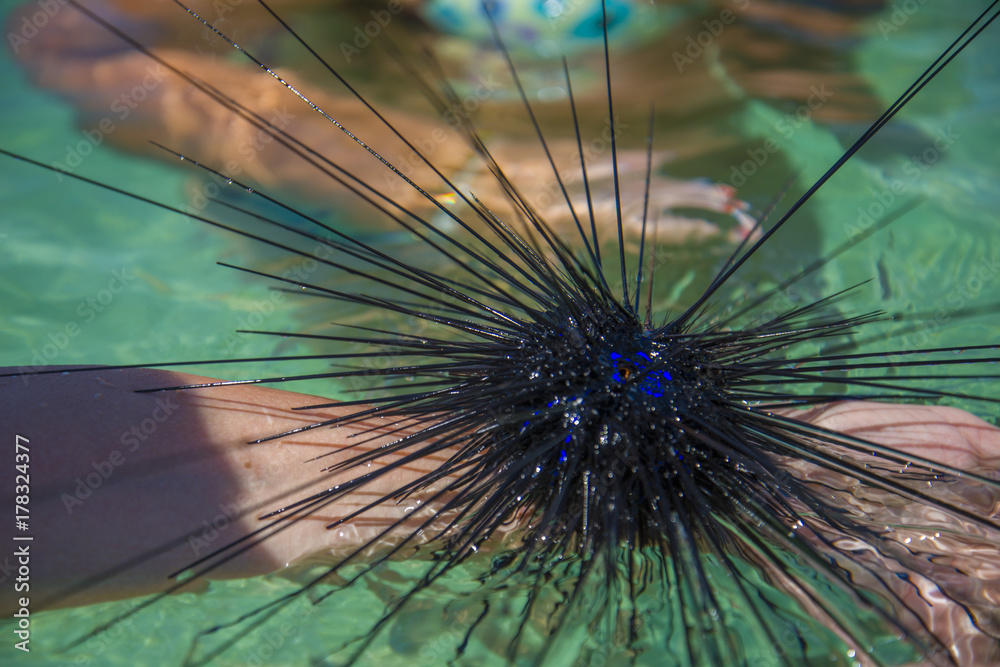 Naklejka premium The sea urchin is sitting on my hand.