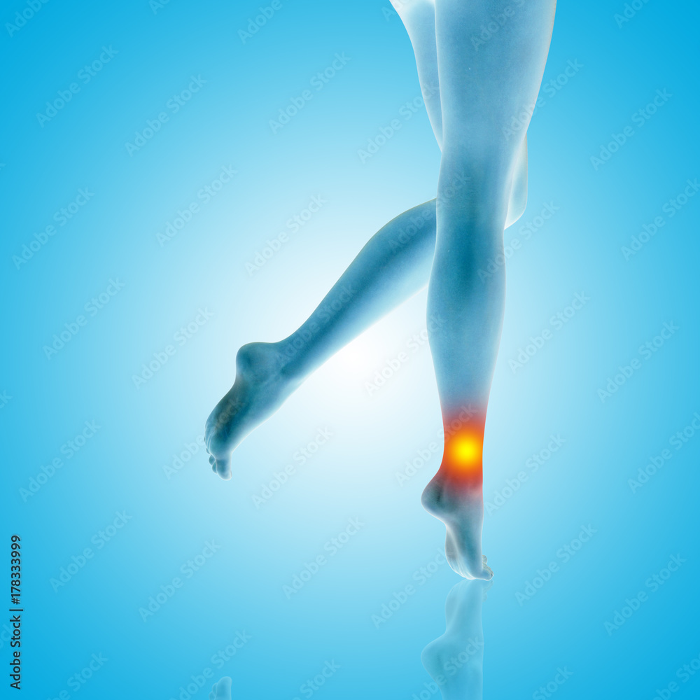 Conceptual beautiful woman or girl legs and feet with a hurt ankle pain or ache closeup, 3D illustration of human slim fit body medical or health care concept, painful sport injury on blue background Conceptual beautiful woman or girl legs and feet with a hurt ankle pain or ache closeup, 3D illustration of human slim fit body medical or health care concept, painful sport injury on blue background