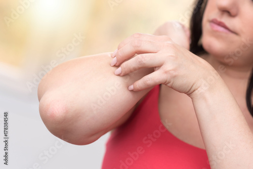 Woman having itchy and scratching her arm  light effect