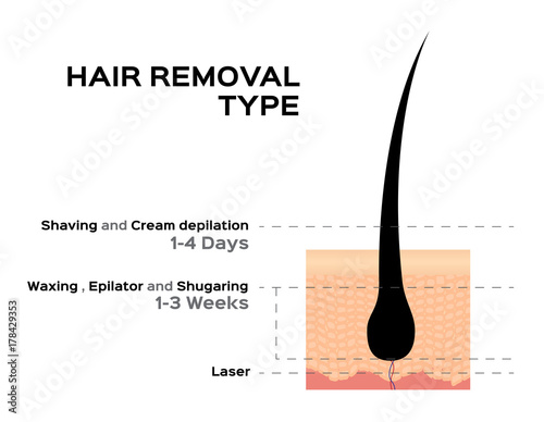 hair removal type vector ( shaving cream depilation waxing epilator sugaring and laser )