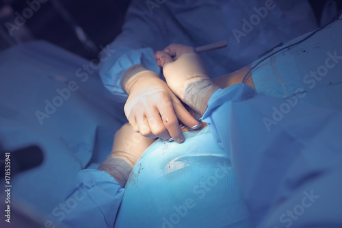 Concerted efforts of two surgeons during operative process