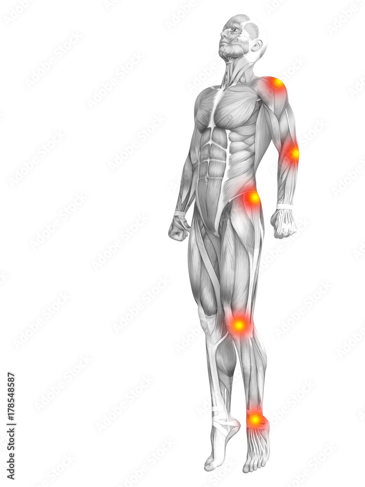 Conceptual human muscle anatomy with red and yellow hot spot inflammation or articular joint pain for health care therapy or sport concepts. 3D illustration man arthritis or bone osteoporosis disease Conceptual human muscle anatomy with red and yellow hot spot inflammation or articular joint pain for health care therapy or sport concepts. 3D illustration man arthritis or bone osteoporosis disease
