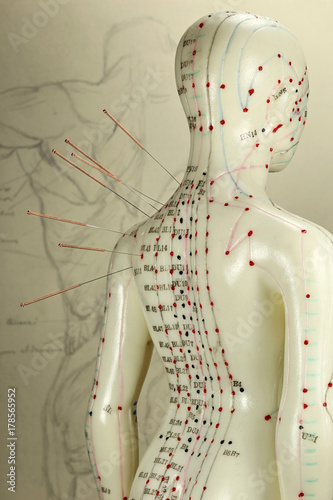 Fototapeta Naklejka Na Ścianę i Meble -  female acupuncture model with needles in the shoulder