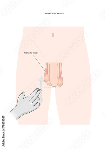Cremasteric reflex, a medical test to check the integrity of the spinal cord after injury or others neurological disorders.