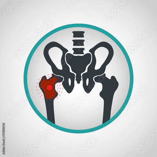 Bone cancer logo vector icon design illustration