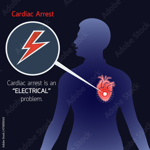Cardiac Arrest vector logo icon illustration