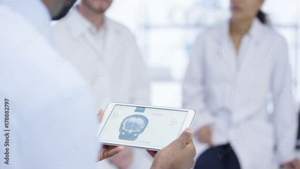 Medical team in a meeting, man holding tablet showing skull x-ray Medical team in a meeting, man holding tablet showing skull x-ray