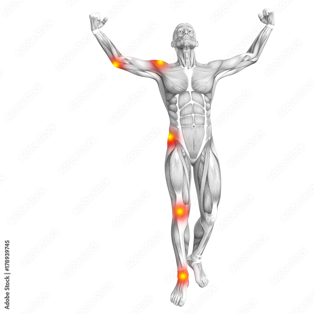 Conceptual human muscle anatomy with red and yellow hot spot inflammation or articular joint pain for health care therapy or sport concepts. 3D illustration man arthritis or bone osteoporosis disease Conceptual human muscle anatomy with red and yellow hot spot inflammation or articular joint pain for health care therapy or sport concepts. 3D illustration man arthritis or bone osteoporosis disease