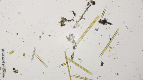Freshwater diatoms under the microscope in 4k photo