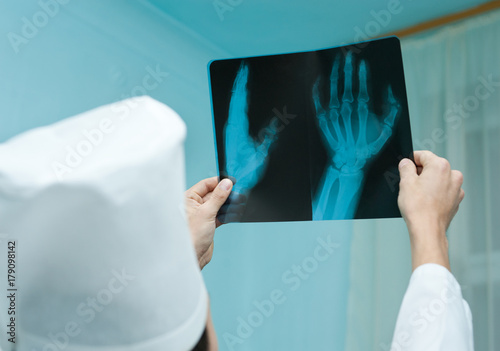 doctor watches X ray film photo