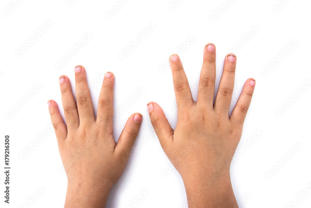 Dirty children finger nails and hands isolated on white background.Dirty finger nails isolated Dirty children finger nails and hands isolated on white background.Dirty finger nails isolated