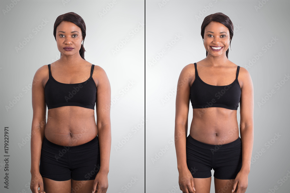 Before And After Concept Showing Fat To Slim Woman Stock Photo