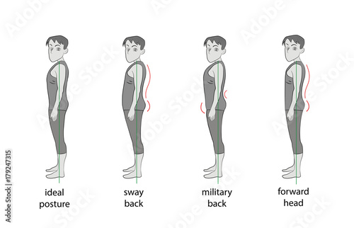 types of posture in men. vector illustration.