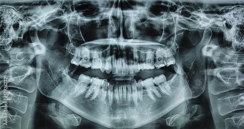 X ray of a womans mouth in 360 rotation