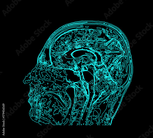 Topographic map MRI of the human brain.