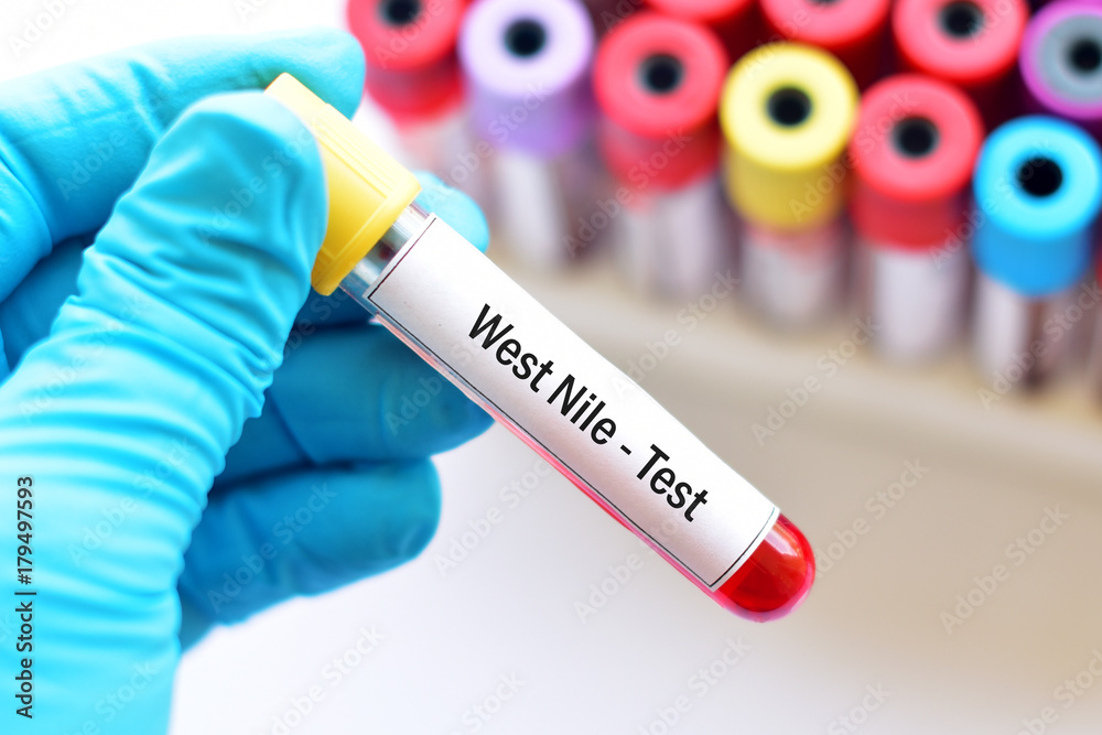 Obraz premium Blood sample for West Nile virus test