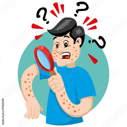 Mascot bob man person, with allergy, rashes and dermatitis, symptom. Ideal for informational and institutional related to medicine