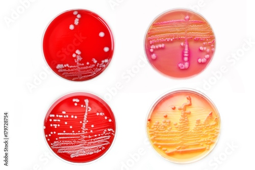 Mixed of bacteria colonies in various petri dish photo