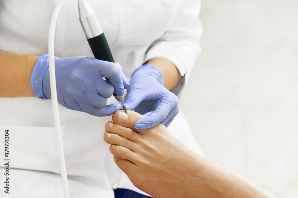 Professional hardware pedicure using electric machine.Patient on