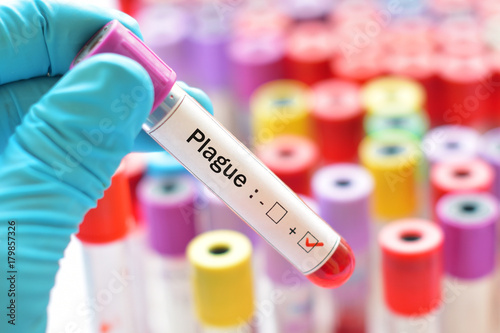 Blood sample positive with plague disease, infectious disease caused by the bacteria Yersinia pestis photo