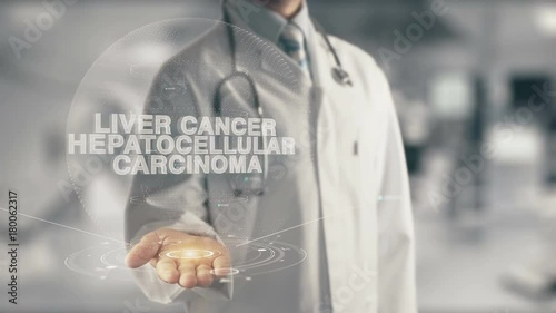 Doctor holding in hand Liver Cancer Hepatocellular Carcinoma photo