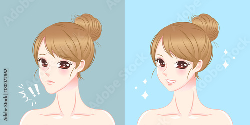 woman with chin surgery