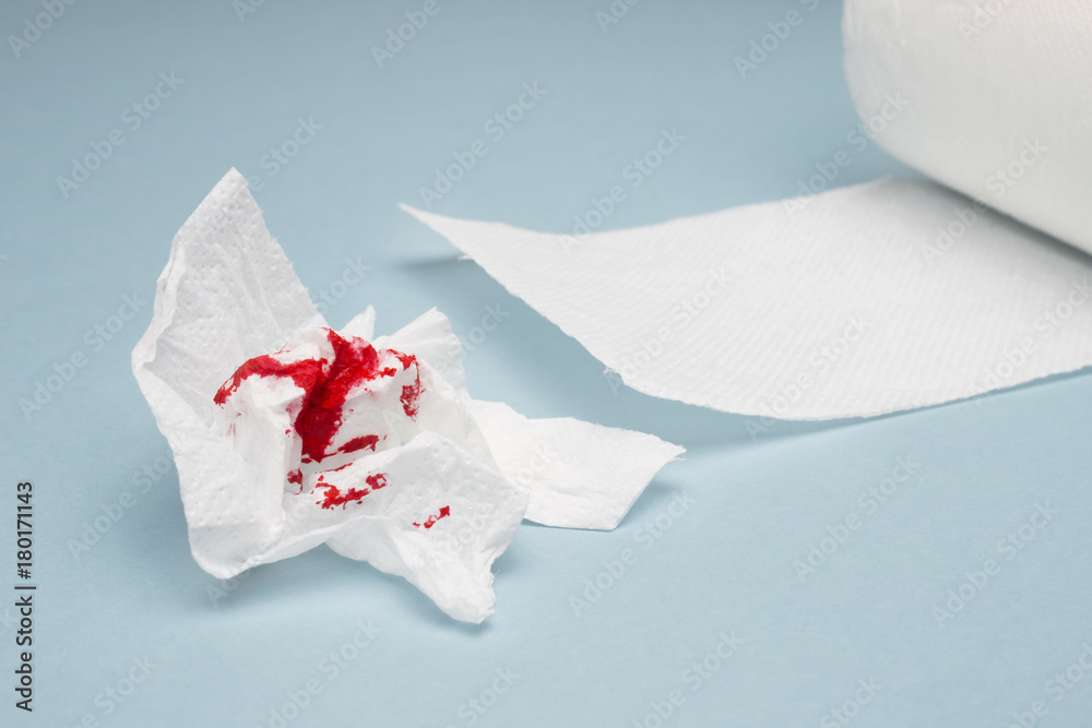 A photo of used bloody toilet paper and a tiolet paper roll on the light  blue background. Hemorrhoids, constipation treatment health problems.  Menstrual, hemorrhoids bleeding. Blood drops and traces Stock Photo