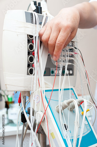 rheoelectroencephalograph - examination of brain blood flow photo