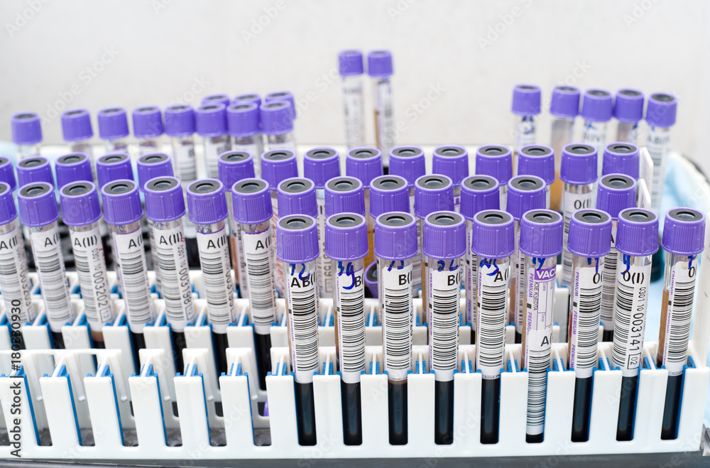Fototapeta premium test tubes with donor blood