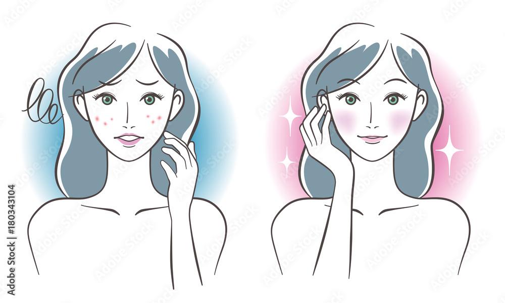 Woman skincare before after concept. Vector illustration. 