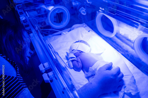 Premature baby recieving UV treatment for jaundice