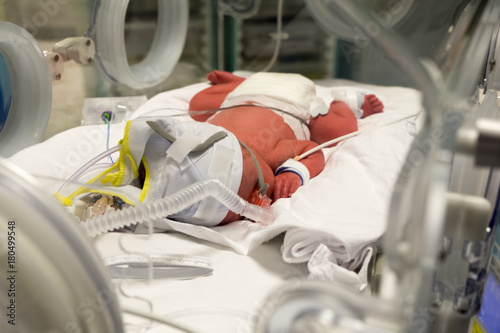 Premature baby being cared for in incubator