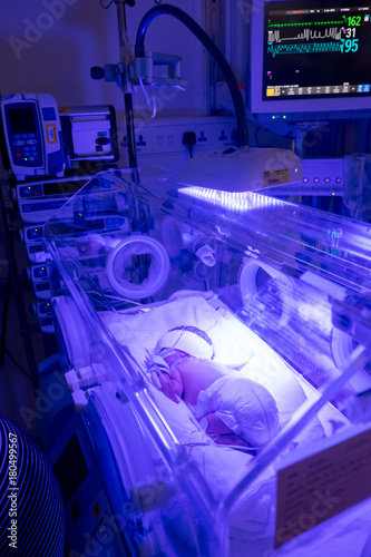 Premature baby recieving UV treatment for jaundice photo